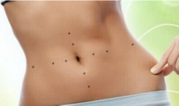 减肥埋线视频全过程,轻松减脂，重塑健康体态